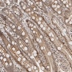 Immunohistochemical staining of human duodenum shows weak to moderate cytoplasmic positivity in glandular cells.