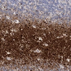 Anti-ATP10B Antibody