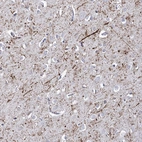Immunohistochemical staining of human cerebral cortex shows strong positivity in neuronal processes.