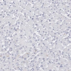 Immunohistochemical staining of human liver shows no positivity in hepatocytes as expected.