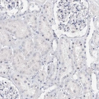 Immunohistochemical staining of human kidney shows no positivity in cells in tubules as expected.