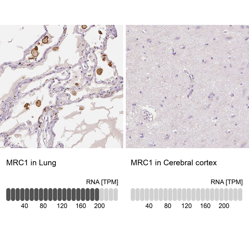 Anti-MRC1 Antibody