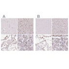 Immunohistochemical staining of human cerebral cortex, liver, lung and placenta using Anti-MRC1 antibody HPA045134 (A) shows similar protein distribution across tissues to independent antibody HPA004114 (B).