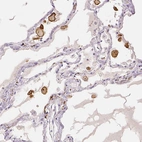 Immunohistochemical staining of human lung shows strong cytoplasmic positivity in macrophages.