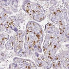 Immunohistochemical staining of human placenta shows strong cytoplasmic positivity in Hofbauer cells.