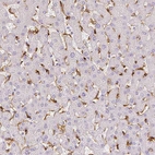 Immunohistochemical staining of human liver shows strong cytoplasmic positivity in Kupffer cells.