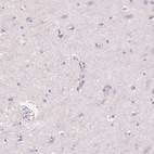 Immunohistochemical staining of human cerebral cortex shows no cytoplasmic positivity in neurons as expected.