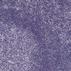 Immunohistochemical staining of human tonsil shows no positivity in non-germinal center cells as expected.