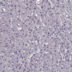 Immunohistochemical staining of human liver shows no positivity in hepatocytes as expected.