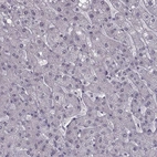 Immunohistochemical staining of human liver shows no positivity in hepatocytes as expected.