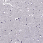 Immunohistochemical staining of human cerebral cortex shows no positivity in neurons as expected.