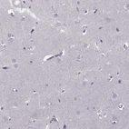 Immunohistochemical staining of human cerebral cortex shows no positivity in neurons as expected.