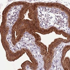 Immunohistochemical staining of human Gallbladder shows strong cytoplasmic and membranous positivity in glandular cells.