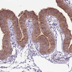 Immunohistochemical staining of human Fallopian tube shows strong membranous and cytoplasmic positivity in glandular cells.