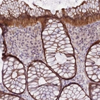 Immunohistochemical staining of human Colon shows strong cytoplasmic and membranous positivity in glandular cells.