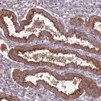 Immunohistochemical staining of human Endometrium shows strong membranous and cytoplasmic positivity in glandular cells.