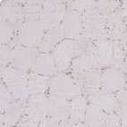 Immunohistochemical staining of human Skeletal muscle shows no positivity in myocytes as expected.