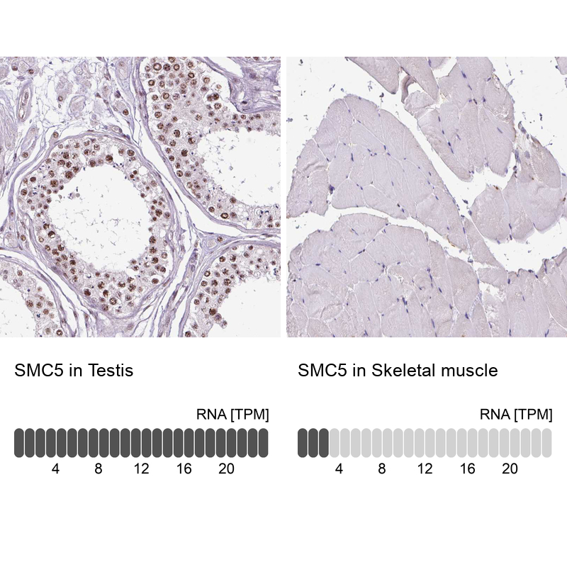 Anti-SMC5 Antibody