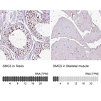 Anti-SMC5 Antibody