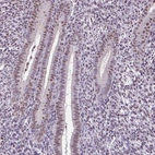 Immunohistochemical staining of human endometrium shows weak nuclear speckles positivity in glandular cells.