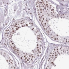 Immunohistochemical staining of human testis shows moderate nuclear speckles positivity in cells in seminiferous ducts.
