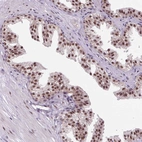 Immunohistochemical staining of human prostate shows moderate nuclear speckles positivity in glandular cells.