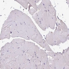 Immunohistochemical staining of human skeletal muscle shows low positivity in myocytes.