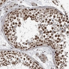 Immunohistochemical staining of human testis shows strong nuclear positivity in cells in seminiferous ducts.
