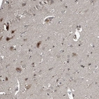 Immunohistochemical staining of human cerebral cortex shows strong nuclear positivity in neurons.