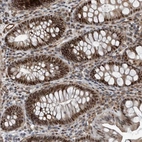 Immunohistochemical staining of human colon shows strong nuclear positivity in glandular cells.