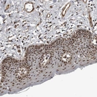 Immunohistochemical staining of human skin shows strong nuclear positivity in squamous epithelial cells.