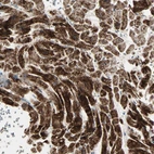 Immunohistochemical staining of human heart muscle shows strong granular cytoplasmic positivity in cardiomyocytes.