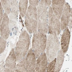 Immunohistochemical staining of human skeletal muscle shows moderate granular cytoplasmic positivity in myocytes.