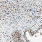 Immunohistochemical staining of human prostate shows moderate granular cytoplasmic positivity in smooth muscle cells.
