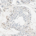 Immunohistochemical staining of human testis shows weak to moderate granular cytoplasmic positivity in a small subset of cells in seminiferous ducts.