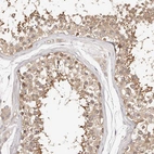 Immunohistochemical staining of human testis shows weak to moderate cytoplasmic positivity in cells in seminiferous ducts.