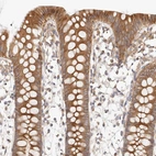 Immunohistochemical staining of human colon shows moderate cytoplasmic positivity in glandular cells.