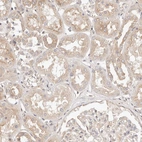 Immunohistochemical staining of human kidney shows weak to moderate cytoplasmic positivity in cells in tubules.