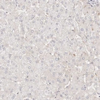 Immunohistochemical staining of human liver shows no cytoplasmic positivity in hepatocytes as expected.