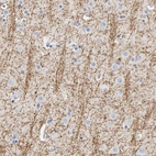 Anti-MOG Antibody