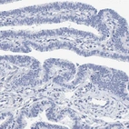 Immunohistochemical staining of human Fallopian tube shows no positivity as expected.