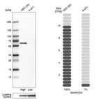 Anti-SMARCD3 Antibody