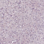 Immunohistochemical staining of human liver shows no positivity in hepatocytes as expected.