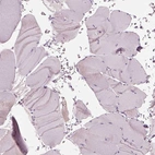 Immunohistochemical staining of human skeletal muscle shows no positivity in myocytes as expected.