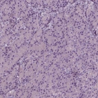 Immunohistochemical staining of human pancreas shows no positivity in exocrine glandular cells as expected.