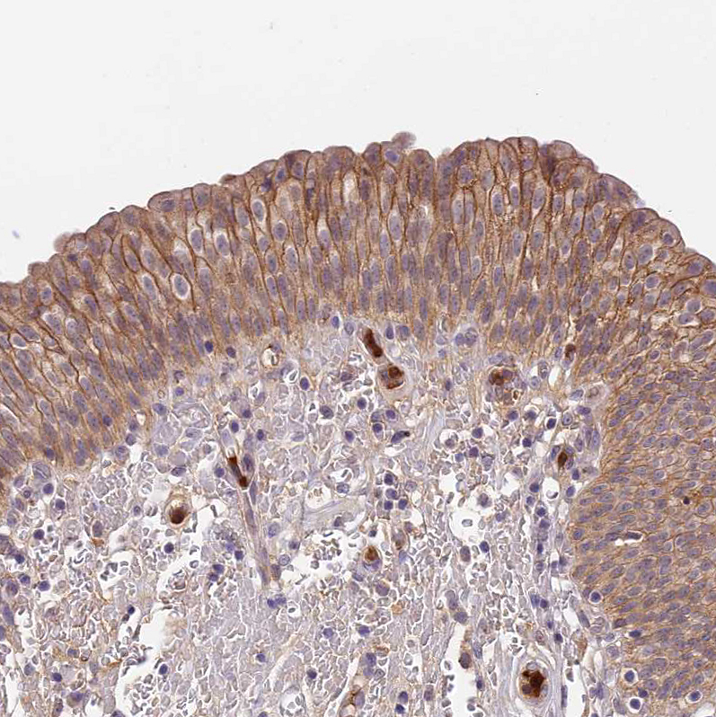 Anti-ADGRD1 Antibody