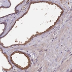 Immunohistochemical staining of human prostate shows moderate membranous and cytoplasmic positivity in glandular cells.