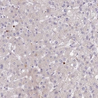 Immunohistochemical staining of human liver shows no positivity in hepatocytes as expected.
