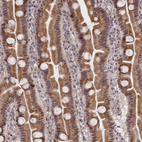 Immunohistochemical staining of human small intestine shows moderate nuclear-cytoplasmic positivity in glandular cells.