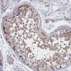 Immunohistochemical staining of human testis shows strong nuclear positivity in subset of cells in seminiferous ducts.